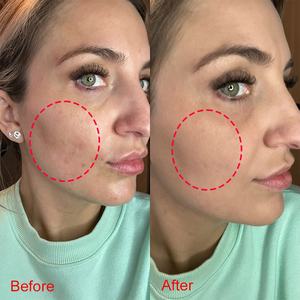 Make up <strong>Mousse</strong> 4 In1 Primer <strong>Foundation</strong> Concealer Powder Waterproof Long Lasting Coverage Dark Spots Dark Spots Makeup <strong>Foundation</strong> - Product Image 2