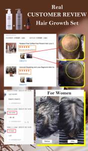 गर्म बालों के विकास के लिए अदरक बायोटिन कॉम्प्लेक्स हाइड्रेशन के साथ अदरक बायोटिन कॉम्प्लेक्स हाइड्रेशन के साथ सेट करें - Product Image 5