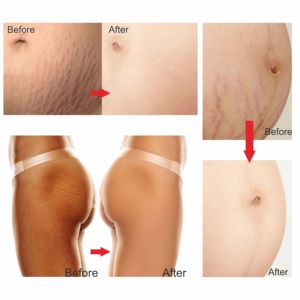 Aceite Esencial de Rosa para el Cuidado del <span class=keywords><strong>Embarazo</strong></span>, Nuevo Lanzamiento, Reafirmante Corporal, Hidratante para el Cuero Cabelludo, Calmante Facial, O'Carly - Product Image 4