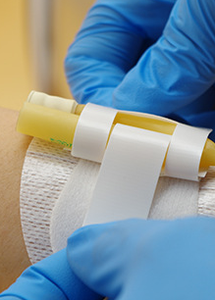 Minh Bạch vết thương Băng bề mặt cơ thể ống thông cố định thiết bị cho ống thông ổn định - Product Image 3