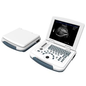 Ecógrafo Doppler Color Inalámbrico de Mano con Doble Sonda, Escáner de Ultrasonido Médico Portátil - Product Image 2