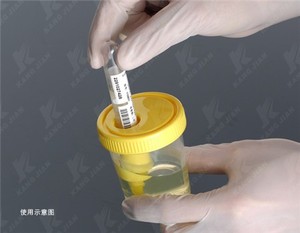 120ml 소변 용기 멸균 소변 표본 컵 - Product Image 6
