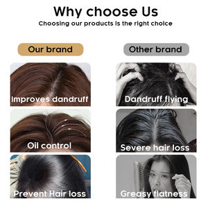 <span class=keywords><strong>Shampooing</strong></span> Joynna unisexe à la formule privée pour le contrôle du sébum, au gingembre, au miel <span class=keywords><strong>et</strong></span> à l'ail, pour cheveux bouclés - Product Image 4