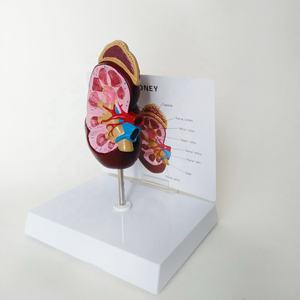 Modelo anatómico de enseñanza de ciencia médica, modelo de disección de riñón humano, modelo educativo de órganos, estructura anatómica de riñón - Product Image 3