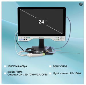 Juego de artroscopia de cistoscopio laparoscópico de 24 pulgadas Cámara endoscópica portátil Full HD 1080P para diagnóstico de cirugía - Product Image 2