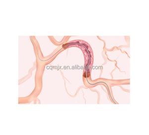Materiales de Intervención Cardiovascular, Guía de PTCA Desechable para Colocación de <span class=keywords><strong>Stent</strong></span> Coronario, OEM y ODM - Product Image 6