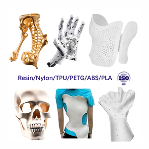 Tıbbi sınıf hafif ilaç Eluting stentler kontrollü yayın geliştirilmiş etkinlik 3D baskı - Product Image 1