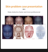 Miroir Magique Intelligent : Analyseur Cutané 3D et Machine de Détection Faciale par IA pour les Pores, les Rides et les Taches