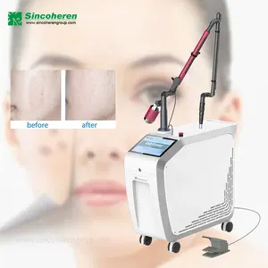 pigment removal 1064nm 532nm pico laser skin rejuvenation q-switch Factory multifunctional skincare ndyag tattoo removal machine