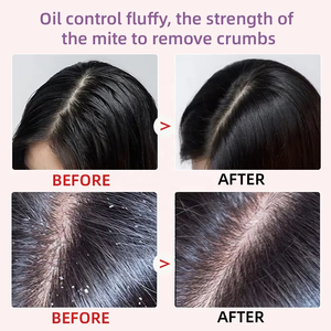 มาส์กผมคาเวียร์แบรนด์ส่วนตัว สำหรับร้านเสริมสวยและสปา  อะมิโนแอซิด ซ่อมแซมผมเสีย บำ<span class=keywords><strong>รุ</strong></span><span class=keywords><strong>ง</strong></span>ให้เรียบลื่น เคราติน ชุ่มชื้น ผลิตภัณฑ์ดูแลเส้นผมจากเกาหลี - Product Image 6