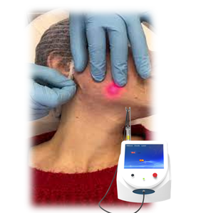 Nuevo 980nm Lipólisis Facial Lifting Endolaser Lipolaser De Diodo Dispositivo Cirugía Plástica Fibra Láser Máquina De Belleza - Product Image 1