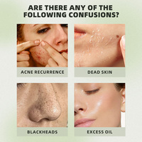 Sensible Rougeurs Acide Salicylique 2% Apaisant Élimination De L'acné Réparation Hydratant Peau Sérum Hydratant Pour Bouton