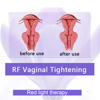 Baguette de resserrement vaginal douce pour la santé féminine, équipement de beauté pour femmes, vibrateur pour le rajeunissement et le resserrement