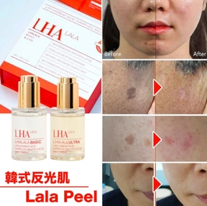 Lhala Peel: Best Chemical Peels for Skin Renewal