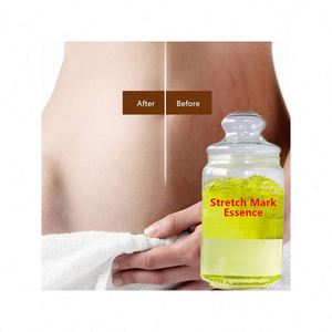 Crème de réparation de vergetures pour cicatrices Pregcy Abdomen Anti <span class=keywords><strong>Vergeture</strong></span> Crème d'élimination des vergetures au beurre de karité biologique pour - Product Image 1