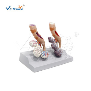 Modelo anatómico comparativo de pulmón de fumador; material didáctico para el control del tabaco; modelo educativo de salud para hospitales y - Product Image 5