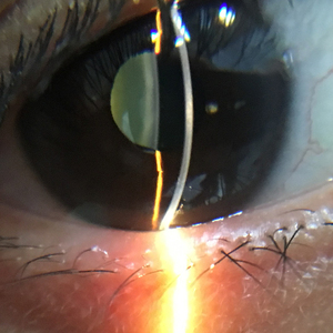 Nhãn khoa kỹ thuật số nhãn khoa tiên tiến đèn khe cầm tay S-150 cộng với tất cả trong một loại cầm tay - Product Image 5