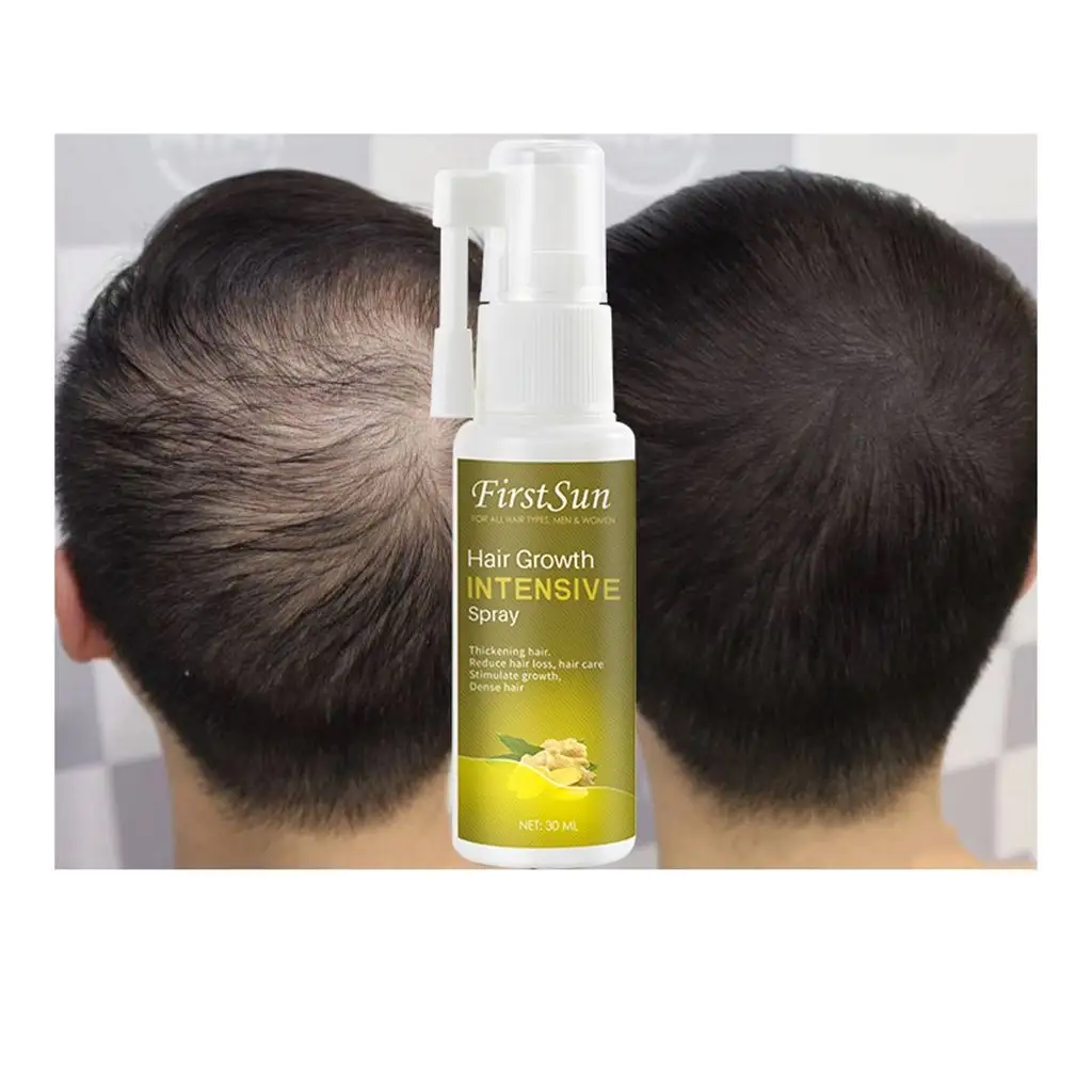 FirstSun 30ml uso doméstico rápido 7 dias gengibre do crescimento do cabelo spray de cabelo spray de crescimento parar a perda de cabelo permanente