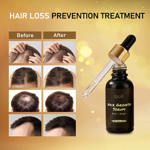 Label pribadi <span class=keywords><strong>Derma</strong></span> Roller Kit Minyak pertumbuhan rambut sikat pemijat kulit kepala merangsang pertumbuhan kembali rambut untuk pria wanita - Product Image 5