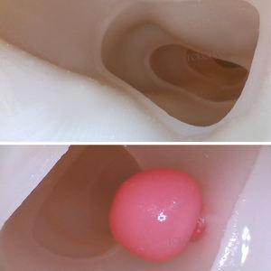 LHNCS Folded Colon Chirurgisches Modell Twisted Colonoscope <span class=keywords><strong>Training</strong></span> Soft Simulation Koloskopie Trainings modell - Product Image 5