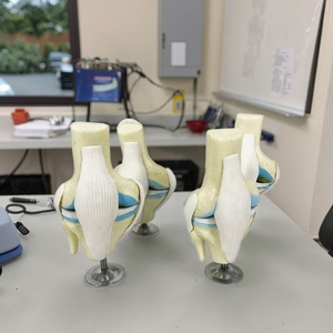 Modelo de Esqueleto Humano de <span class=keywords><strong>Rodilla</strong></span> con Osteoartritis de 4 Etapas para Enseñanza Médica y Demostración Ortopédica - Product Image 1