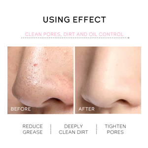 Crème pour le nez LAIKOU JAPAN SAKURA PEEL, vente en gros, crème nourrissante pour le visage, raffermissante, anti-âge, à l'acide mandélique, pour tous types de peaux, à base de produits chimiques - Product Image 4