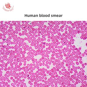 Diapositivas de histología humana Frotis de sangre humana de alta educación Recursos de enseñanza de vidrio transparente Diapositivas de microscopio preparadas con tejido humano - Product Image 6