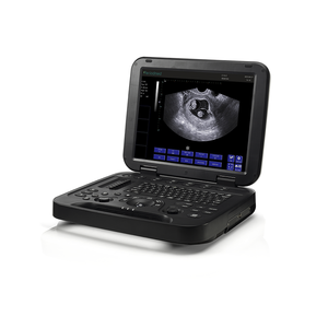 เครื่องอัลตราซาวนด์วัวแบบพกพาสำหรับสัตวแพทย์ รุ่น VDL151A Periodmed เครื่องอัลตราซาวนด์วัวสำหรับสัตวแพทย์ VDL151A VDL151A - Product Image 1