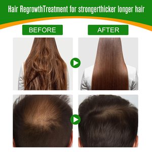 Formule hydratante biologique, huile de Batana pure, traitement naturel de la croissance des cheveux, réparation du cuir chevelu, renforce les cheveux, solution contre la perte de cheveux, voyage sec - Product Image 2