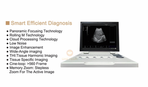 Diagnosis umum mesin <span class=keywords><strong>Ultrasound</strong></span> portabel, pemindai <span class=keywords><strong>Ultrasound</strong></span> Laptop <span class=keywords><strong>15</strong></span> inci DICOM dan PW fungsional B51 - Product Image 5