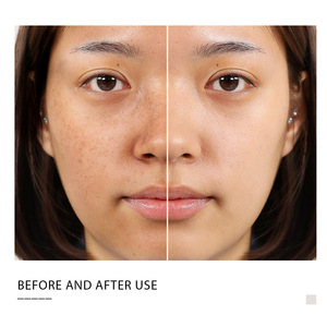 AIFEILIER Crème Hydratante Naturelle Correcteur Lady Crème avec Niacinamide & Cordyceps Thé Vert Formule Blanchissante - Product Image 2