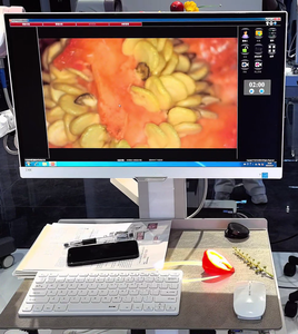 Kernel High-Accuracy Colposcopy Equipment for <strong>Womens</strong> Health Clinics Optical <strong>Colposcope</strong> KN-2200B 32X Optical Zoom LED - Product Image 2