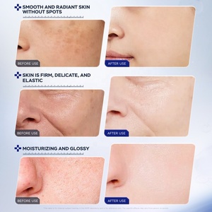 Esp הפנים תמצית הלבנת נמש הסרת נמש אנטי-אייג 'ינג עם ויטמין <span class=keywords><strong>c</strong></span> <span class=keywords><strong>niacinamide</strong></span> - Product Image 4