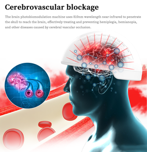 <span class=keywords><strong>Parkinson</strong></span> Dementia Healing 810nm Enfermedad de Alzheimer Terapia de luz roja Gorra Casco OEM Controlador Personalización - Product Image 3