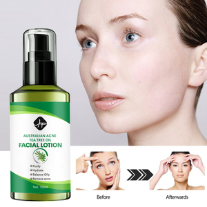 Yf Chống Mụn Trứng Cá Chăm Sóc Da Thiết Lập Loại Bỏ Mụn Trứng Cá & Mụn Với Trà Cây Dầu Nhãn Hiệu Riêng Mạnh Mẽ Hiệu Quả Chống Điều Trị Trên Khuôn Mặt Thiết Lập - Product Image 4