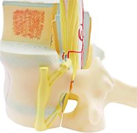 Modelo Médico de Columna Vertebral y Vértebras Yulin, Apto para Investigación Ortopédica, Enseñanza de Patología Espinal, Educativo, CE/ISO