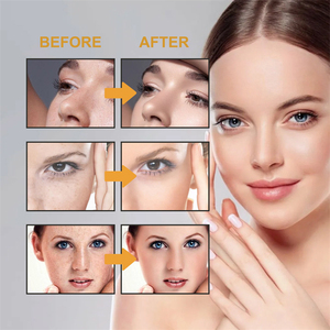 Jaysuing crème éclaircissante speckile chloasma enlever hydratant meilleure qualité blanchissant anti-taches crème - Product Image 6