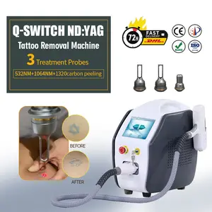 Niet-Invasieve Q Switch Nd Yag Laser Tattoo Pigment Verwijdering Machine Wenkbrauw Pigment Tattoo Verwijdering Ndyag Laser Machine