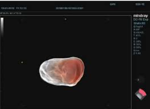 Máquina de Ultrassom <span class=keywords><strong>Mindray</strong></span> <span class=keywords><strong>DC</strong></span>-<span class=keywords><strong>70</strong></span> X-insight para Uso Veterinário com Sistema de Imagem Diagnóstica e Ultrassom Doppler Colorido em Full HD - Product Image 5