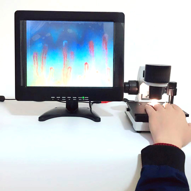 12INCH Nailfold Capillary Microcirculation Detector Digital Microscope Blood Microcirculation Instrument LCD Display