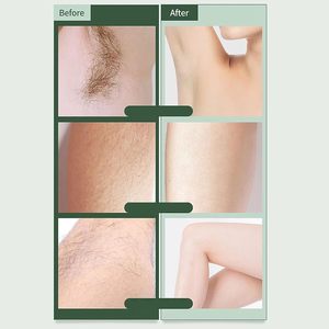 Afeitadora eléctrica indolora segura y cómoda para mujer, afeitadora y recortadora de Bikini Personal de uso en seco para uso doméstico y en el automóvil - Product Image 3