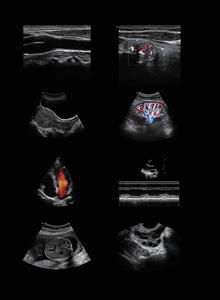 Sonoscabo scanner colorido p9, ultrassom para carrinho - Product Image 5
