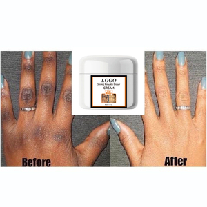 BLIW-Corrector de manchas oscuras personalizado, crema blanqueadora de piel brillante, crema para nudillos oscuros, venta al por mayor - Product Image 2