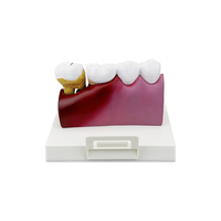 Modèle de structure anatomique standard pour l'enseignement dentaire, en résine durable, modèle complet de dents pour dentistes et étudiants en dentisterie