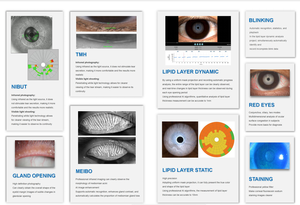 Analizador de Superficie Ocular de Alta Precisión para Diagnóstico de Enfermedades Oftálmicas, Analizador de Ojo Seco para Oftalmólogos - Product Image 5