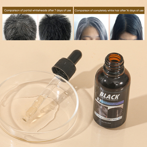 เซรั่มบำรุงผมดำ 30 มล. วิตามิน B7 สำหรับ<span class=keywords><strong>ผม</strong></span><span class=keywords><strong>ขาว</strong></span> ช่วยฟื้นฟูเมลานิน ให้กลับมาดำขึ้น รับผลิตแบรนด์ส่วนตัว (ขายส่ง) - Product Image 4