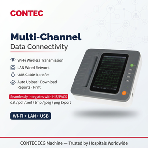 CONTEC E12 cardioline ecg machine ekg ecg moniteur elettrocardiografo - Product Image 5