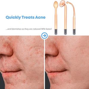 AU-808 macchina facciale ad alta frequenza per uso domestico ad alta frequenza di terapia attrezzatura di bellezza con noi JP EU spine tipo Desktop - Product Image 6