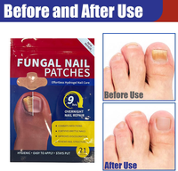Patchs antifongiques en gros pour les ongles, patchs adhésifs antifongiques, gel de traitement des mycoses des ongles pour la vie quotidienne