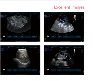 Equipo <span class=keywords><strong>de</strong></span> Diagnóstico Veterinario <span class=keywords><strong>de</strong></span> Ultrasonido Negro, <span class=keywords><strong>Precio</strong></span> <span class=keywords><strong>de</strong></span> Fábrica, Gran Venta - Product Image 3